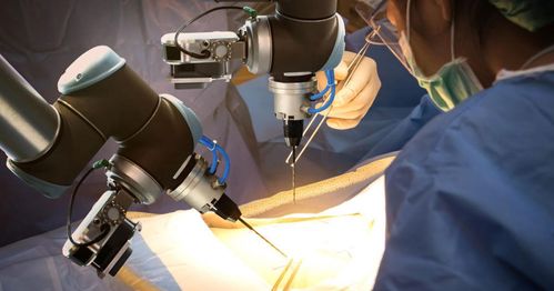 医疗器械开发的自动化浪潮 驱动大型医疗器械自动化的核心原因